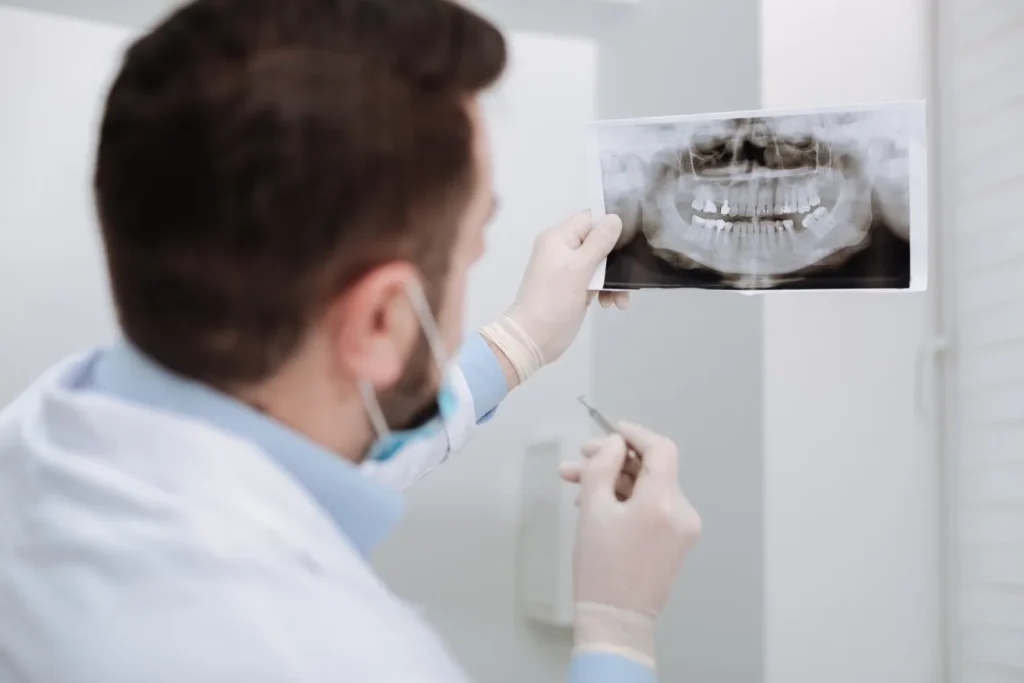 În cât timp se vindecă gingia după un implant dentar? – etapele recuperării și tratarea durerilor