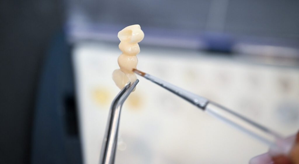 Protetică dentară