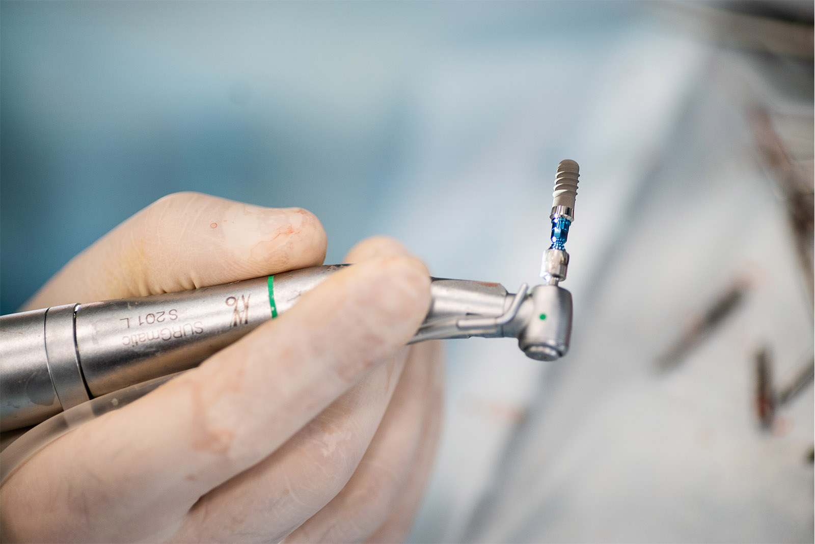 Tratamente endodontice