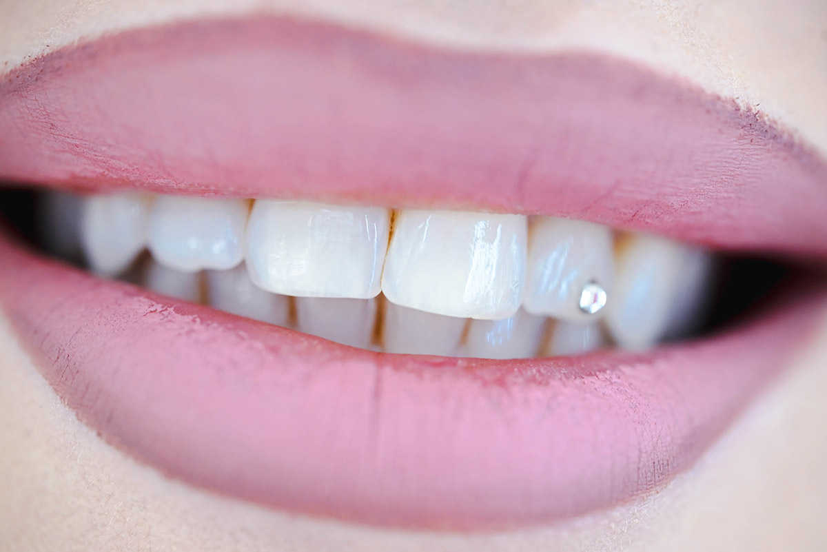 Protetică dentară