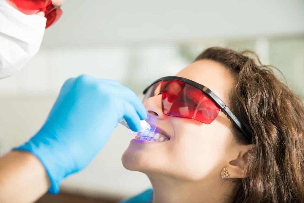 Metode profesionale de albire dentară - albire profesionala la dentist
