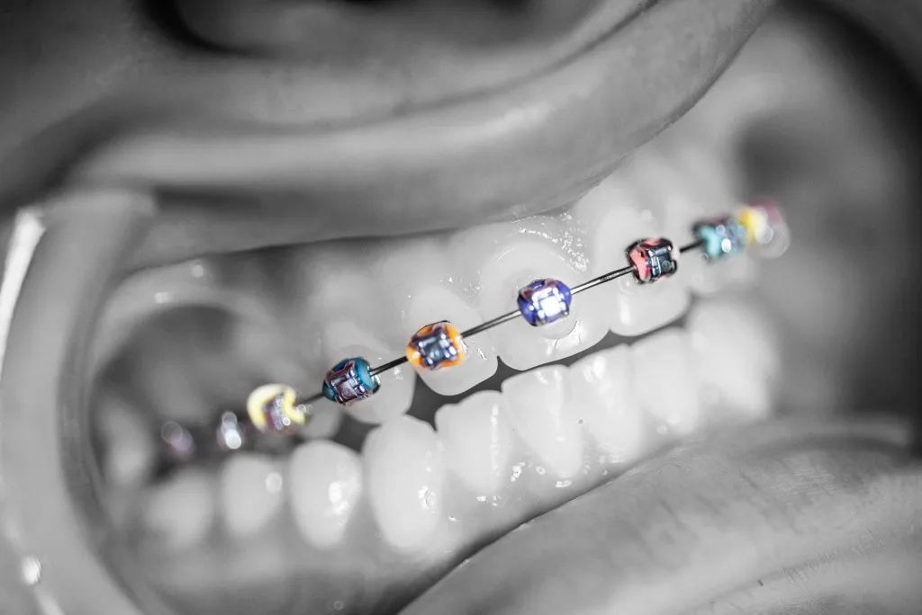 Terapie și estetică dentară Constanta - toldimed.ro